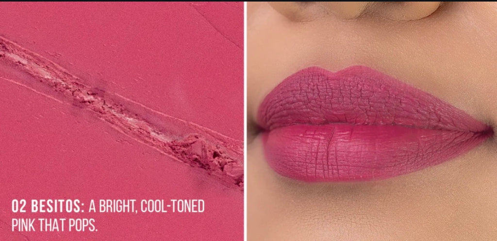 Labial Locked in Place  02
