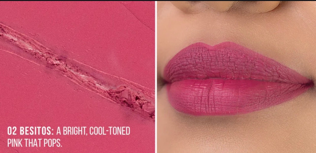 Labial Locked in Place  02